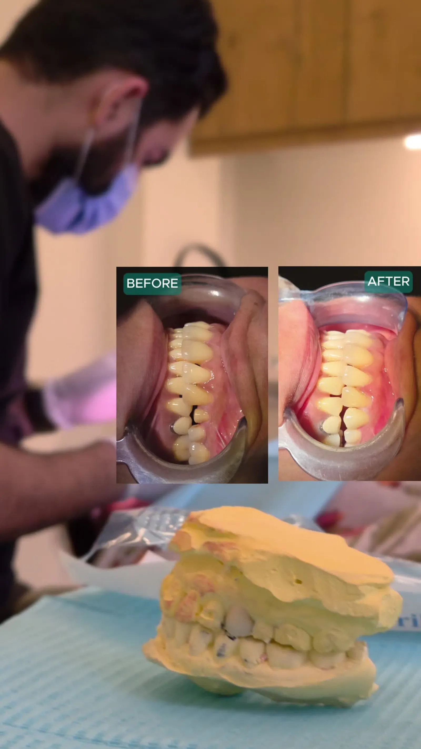 The Smile Xperts social reel poster creative